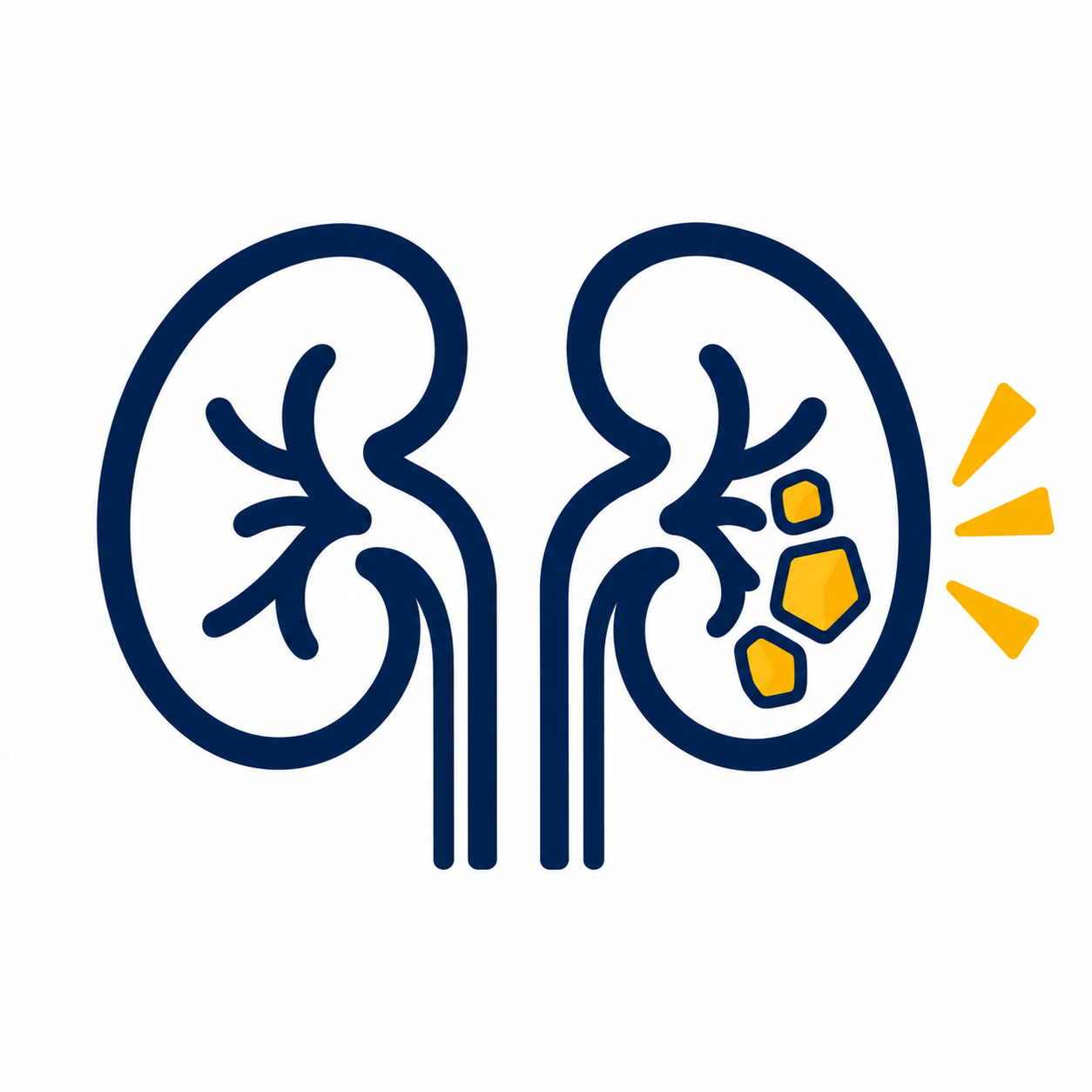 kidney stones